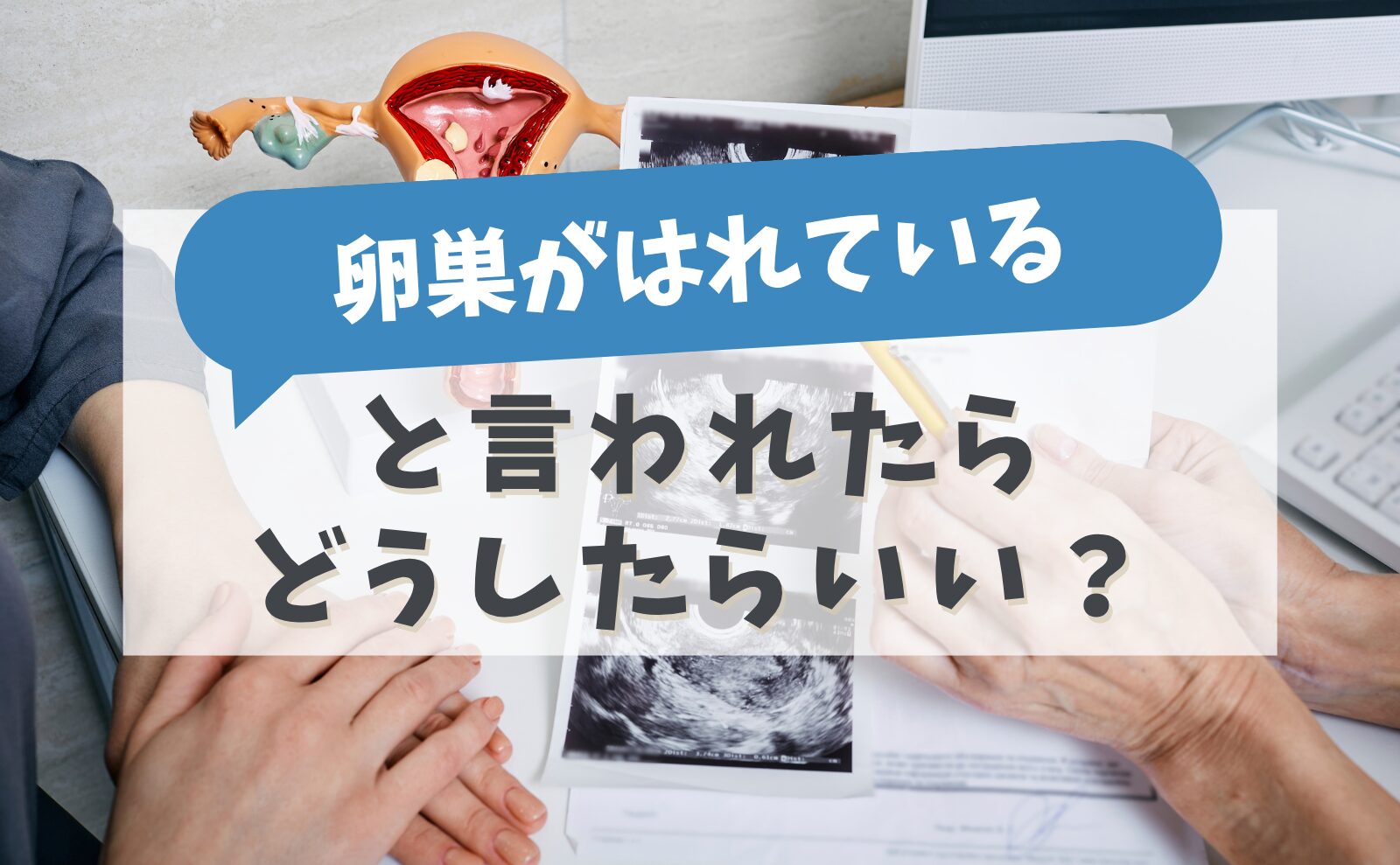「卵巣がはれている」と言われたらどうしたらいい?