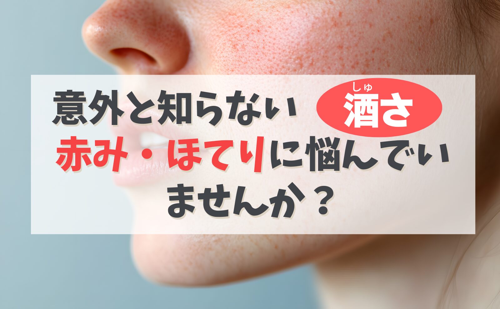 意外と知らない「酒さ」 赤み・ほてりに悩んでいませんか?